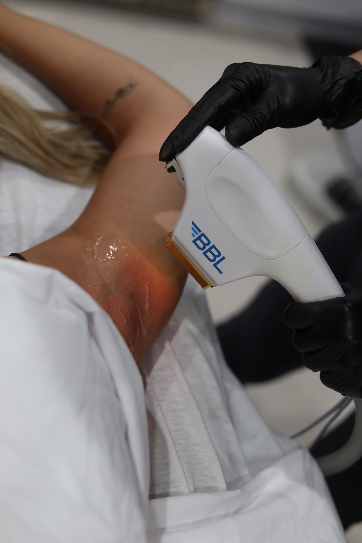 Epilation Aisselles