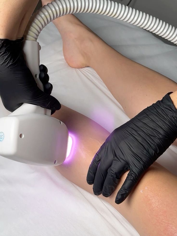 Epilation Demi jambes